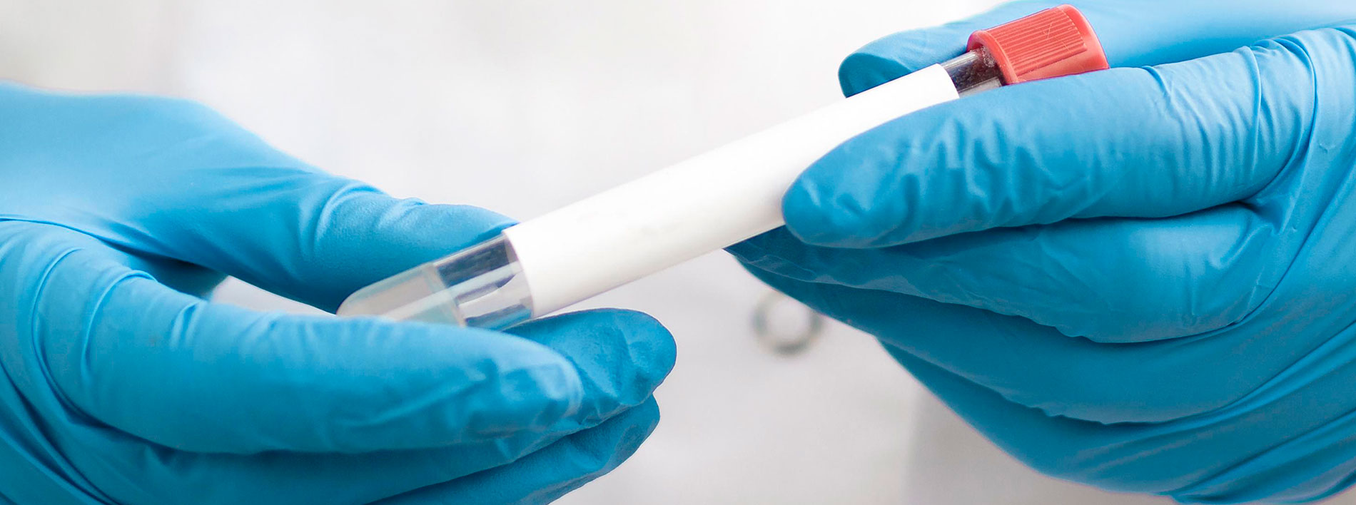 Cribado y prevención: las claves para detectar el cáncer a tiempo